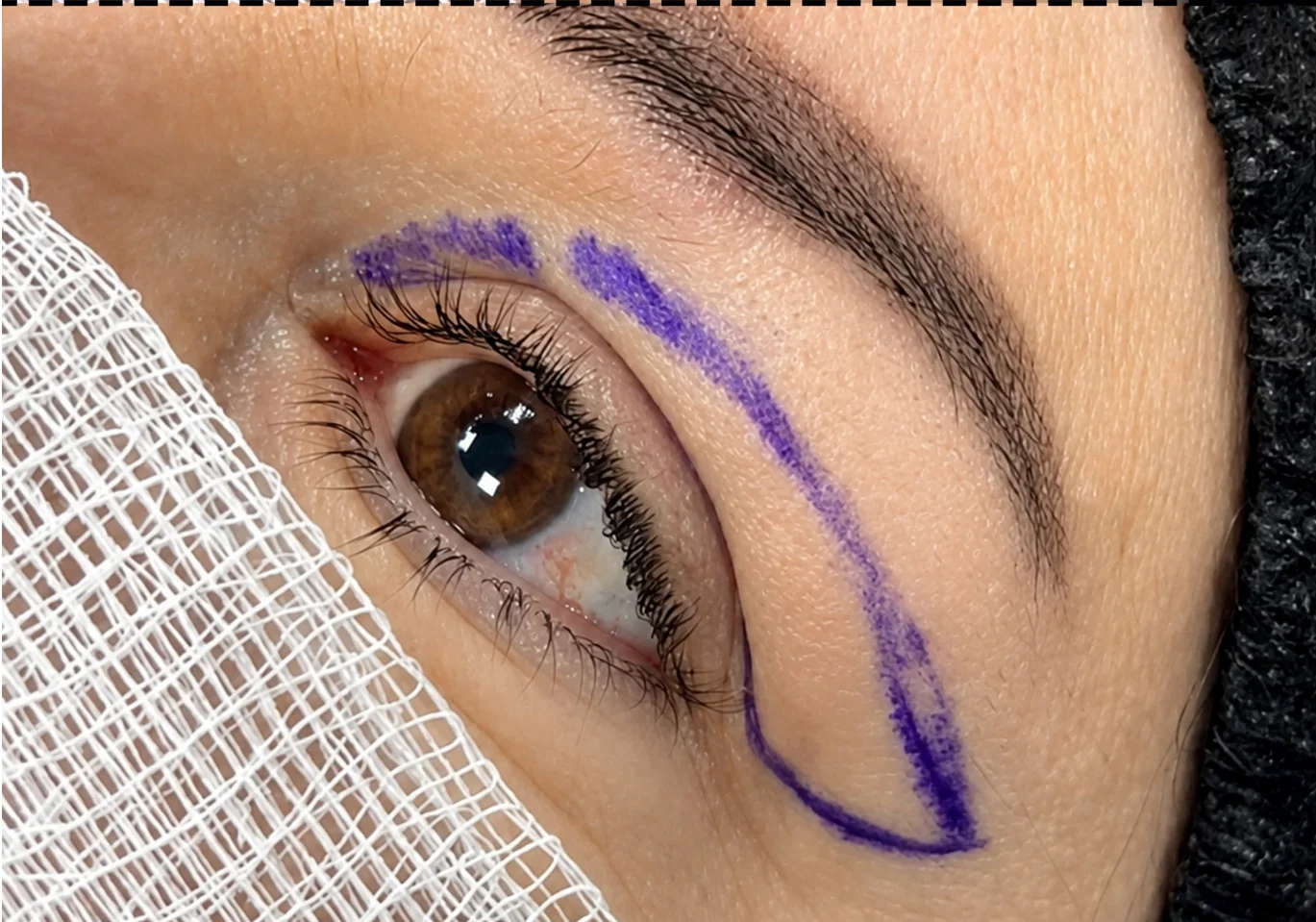 Before